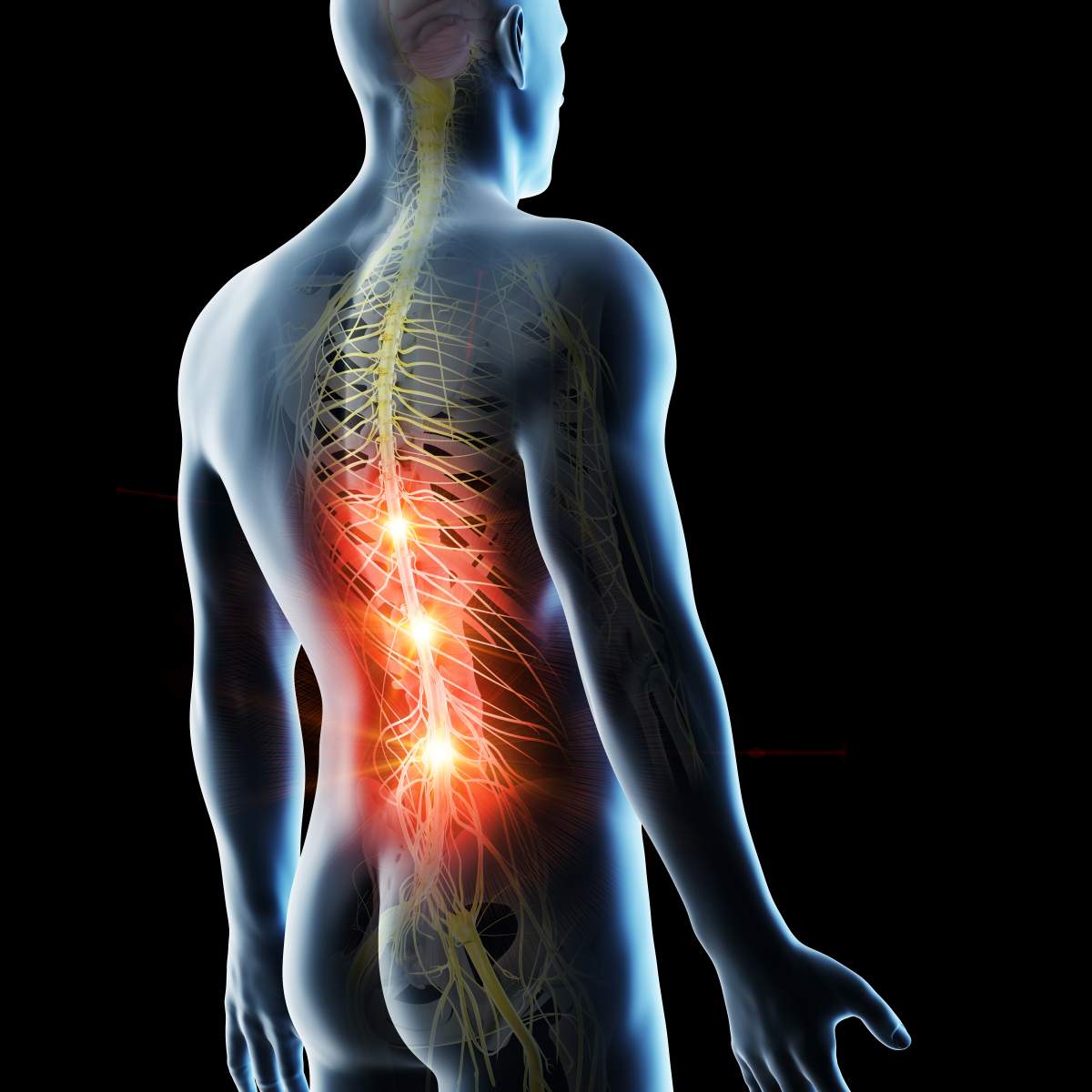 what-is-nerve-pain-elite-physical-therapy